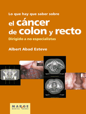 cover image of Lo que hay que saber sobre el cáncer de colon y recto